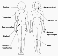 Where are the tender points for Fibromyalgia?