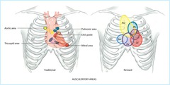 Where to auscultate aortic, pulmonic, tricuspid, mitral/apex valves