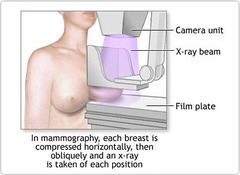 Yearly mammograms are to be initiated when?