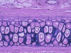 chondrocyte