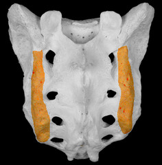lateral sacral crest