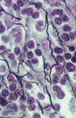 Reticular Cells